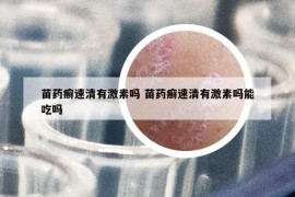 苗藥癬速清有激素嗎 苗藥癬速清有激素嗎能吃嗎