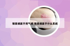 銀屑病屬于陰氣病 銀屑病屬于什么系統(tǒng)