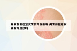 男朋友會在意女生有牛皮癬嘛 男生會在意女朋友雞皮膚嗎