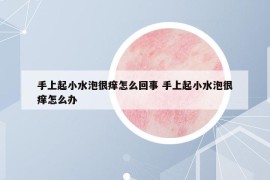 手上起小水泡很癢怎么回事 手上起小水泡很癢怎么辦