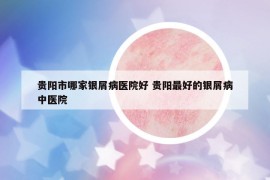 貴陽市哪家銀屑病醫(yī)院好 貴陽最好的銀屑病中醫(yī)院