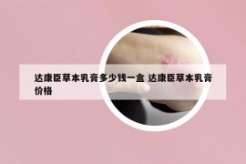 達康臣草本乳膏多少錢一盒 達康臣草本乳膏價格