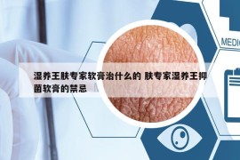 濕養(yǎng)王膚專家軟膏治什么的 膚專家濕養(yǎng)王抑菌軟膏的禁忌
