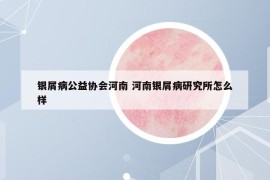 銀屑病公益協(xié)會(huì)河南 河南銀屑病研究所怎么樣