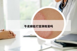 牛皮癬能打?qū)m頸疫苗嗎