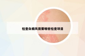 檢查白癜風(fēng)需要哪些檢查項(xiàng)目