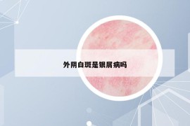 外陰白斑是銀屑病嗎