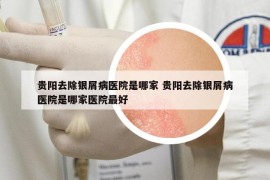 貴陽(yáng)去除銀屑病醫(yī)院是哪家 貴陽(yáng)去除銀屑病醫(yī)院是哪家醫(yī)院最好