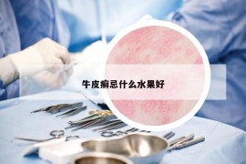 牛皮癬忌什么水果好