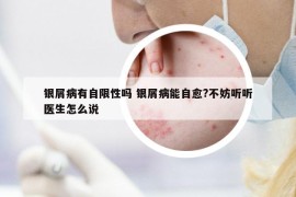 銀屑病有自限性嗎 銀屑病能自愈?不妨聽聽醫(yī)生怎么說