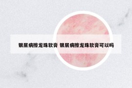 銀屑病擦龍珠軟膏 銀屑病擦龍珠軟膏可以嗎