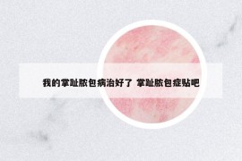 我的掌趾膿包病治好了 掌趾膿包癥貼吧