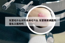 東營吃什么對牛皮癬吃什么 東營銀屑病醫(yī)院是私立醫(yī)院嗎