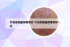 寧波皮膚醫(yī)院哪家好 寧波皮膚醫(yī)院哪家好一點