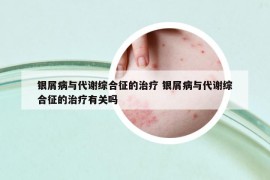 銀屑病與代謝綜合征的治療 銀屑病與代謝綜合征的治療有關(guān)嗎