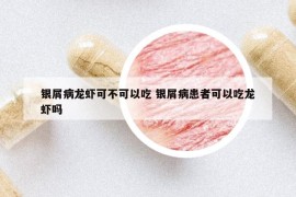 銀屑病龍蝦可不可以吃 銀屑病患者可以吃龍蝦嗎