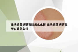 濰坊銀屑病研究院怎么么樣 濰坊銀屑病研究所口碑怎么樣