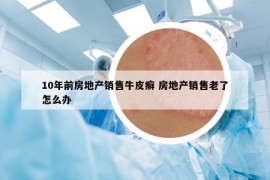 10年前房地產(chǎn)銷售牛皮癬 房地產(chǎn)銷售老了怎么辦