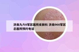 濟(jì)南九六0軍區(qū)醫(yī)院皮膚科 濟(jì)南960軍區(qū)總醫(yī)院預(yù)約電話