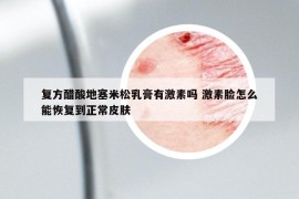 復(fù)方醋酸地塞米松乳膏有激素嗎 激素臉怎么能恢復(fù)到正常皮膚