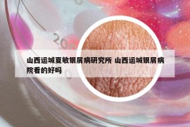 山西運(yùn)城夏敏銀屑病研究所 山西運(yùn)城銀屑病院看的好嗎