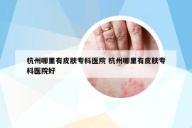 杭州哪里有皮膚?？漆t(yī)院 杭州哪里有皮膚專科醫(yī)院好