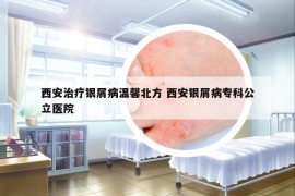 西安治療銀屑病溫馨北方 西安銀屑病?？乒⑨t(yī)院