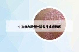 牛皮癬志愿者計(jì)劃書 牛皮癬標(biāo)語(yǔ)