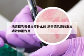 地奈德乳膏是治療什么的 地奈德乳膏的主治功效和副作用