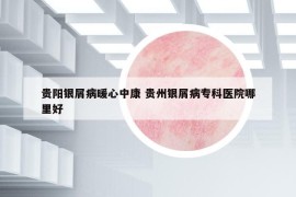 貴陽(yáng)銀屑病暖心中康 貴州銀屑病專科醫(yī)院哪里好