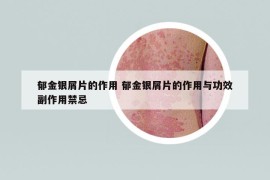 郁金銀屑片的作用 郁金銀屑片的作用與功效副作用禁忌