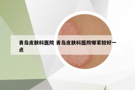 青島皮膚科醫(yī)院 青島皮膚科醫(yī)院哪家較好一點