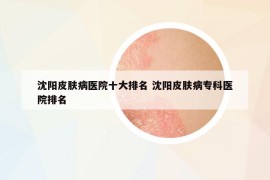 沈陽皮膚病醫(yī)院十大排名 沈陽皮膚病?？漆t(yī)院排名