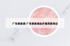 廣東銀屑病 廣東銀屑病治療推薦新世紀