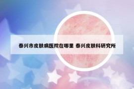 泰興市皮膚病醫(yī)院在哪里 泰興皮膚科研究所