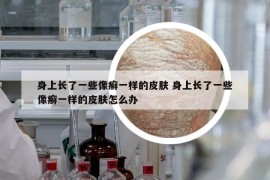 身上長了一些像癬一樣的皮膚 身上長了一些像癬一樣的皮膚怎么辦