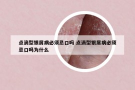 點滴型銀屑病必須忌口嗎 點滴型銀屑病必須忌口嗎為什么