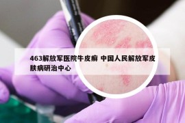 463解放軍醫(yī)院牛皮癬 中國(guó)人民解放軍皮膚病研治中心
