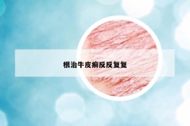 根治牛皮癬反反復(fù)復(fù)
