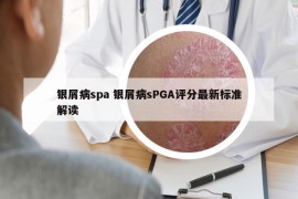 銀屑病spa 銀屑病sPGA評分最新標(biāo)準(zhǔn)解讀