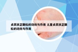 貞芪扶正顆粒的功效與作用 兒童貞芪扶正顆粒的功效與作用