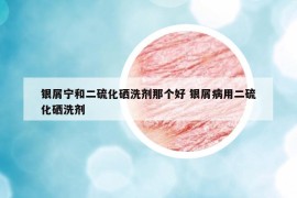 銀屑寧和二硫化硒洗劑那個好 銀屑病用二硫化硒洗劑
