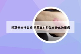 樂草元治療頭癬 樂草元對(duì)脫發(fā)有什么效果嗎
