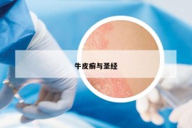 牛皮癬與圣經(jīng)