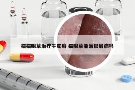 貓貓眼草治療牛皮癬 貓眼草能治銀屑病嗎