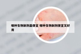 哪種生物制劑最便宜 哪種生物制劑便宜又好用