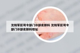 沈陽(yáng)軍區(qū)司令部門診部皮膚科 沈陽(yáng)軍區(qū)司令部門診部皮膚科地址