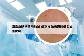 盛京皮膚病醫(yī)院地址 盛京皮膚病醫(yī)院是公立醫(yī)院嗎