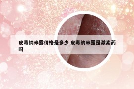 皮毒納米露價(jià)格是多少 皮毒納米露是激素藥嗎