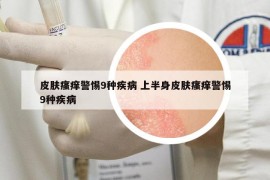 皮膚瘙癢警惕9種疾病 上半身皮膚瘙癢警惕9種疾病